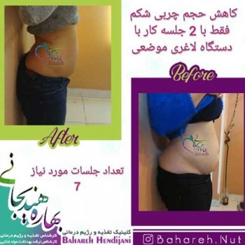 نتیجه رژیم لاغری