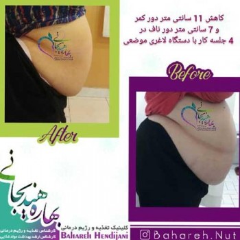 نتیجه رژیم لاغری