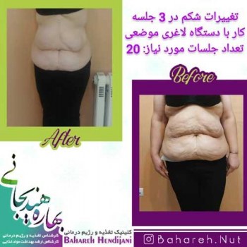 نتیجه رژیم لاغری