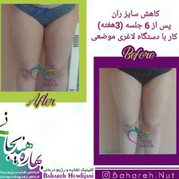 نتیجه رژیم لاغری