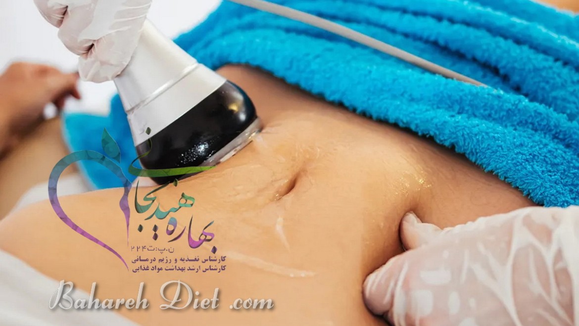 هزینه لاغری با دستگاه آر اف