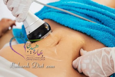 هزینه لاغری با دستگاه آر اف