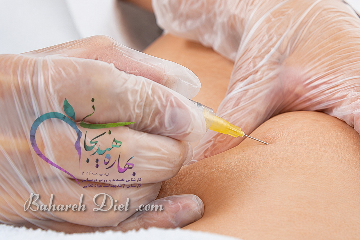 کربوکسی تراپی شکم ۲