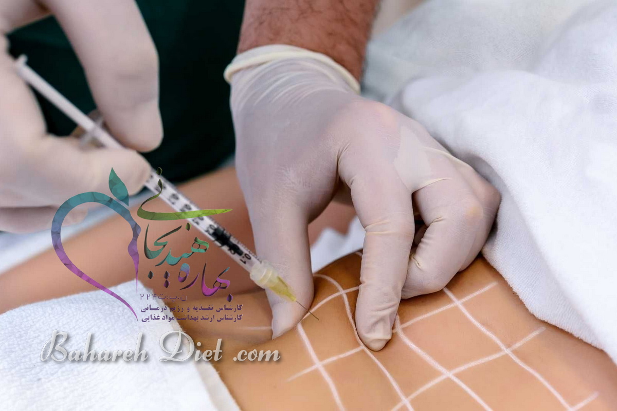 کربوکسی تراپی شکم ۳