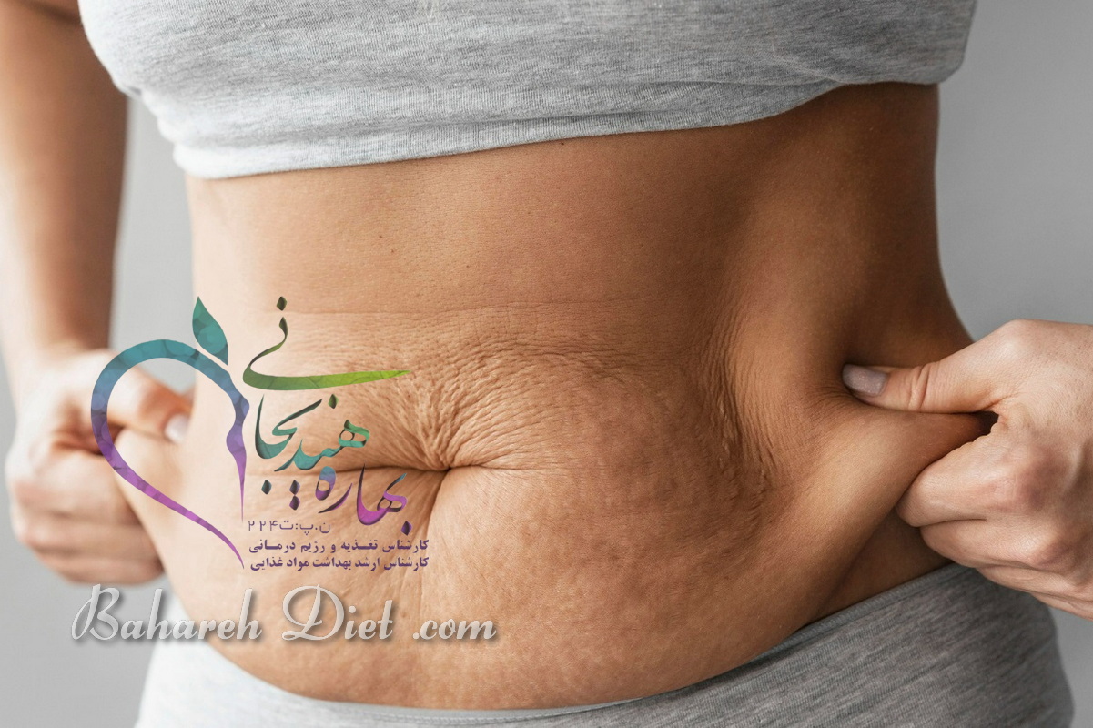 کربوکسی تراپی شکم ۶